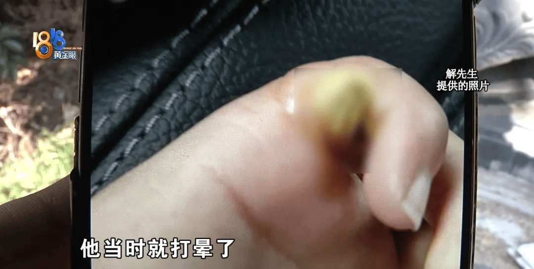 5岁男童瞬间晕厥<strong></p>
<p>币乎下载</strong>，筋都断了！街上常见，看见立即远离