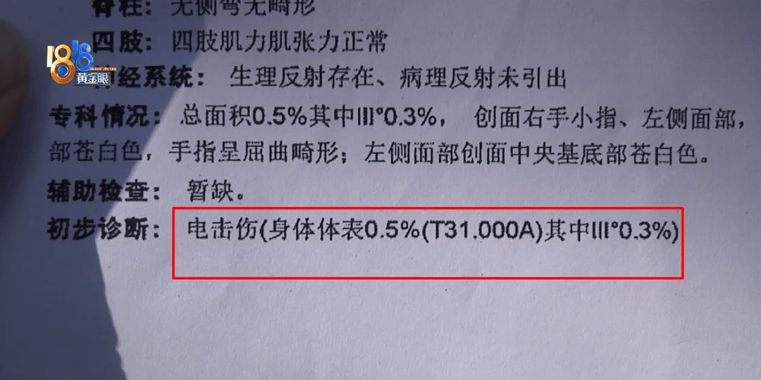 5岁男童瞬间晕厥<strong></p>
<p>币乎下载</strong>，筋都断了！街上常见，看见立即远离