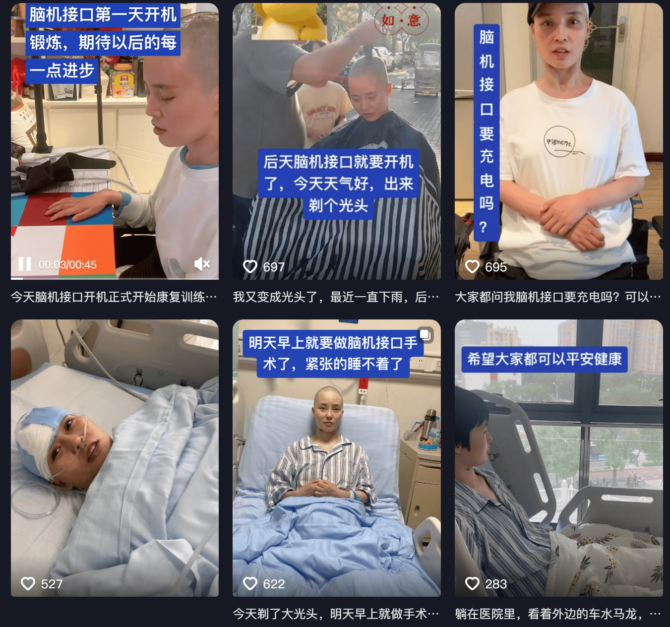 女子因车祸全身瘫痪6年仅嘴眼能动<strong></p>
<p>比特币市值</strong>，接受脑机接口手术后通过意念抓取物品！当事人讲述