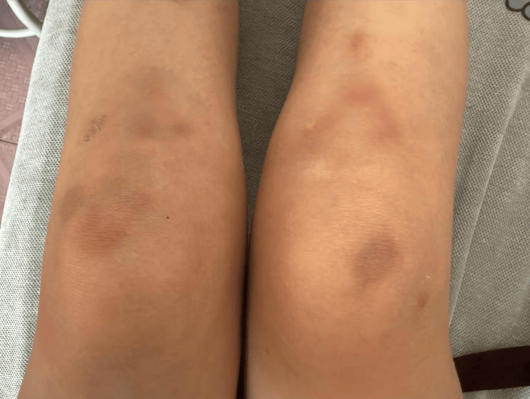 女子自称因工资问题被老板锁办公室里打 警方：双方已到派出所<strong></p>
<p>比特币今日行情走势</strong>，是否打人还在调查