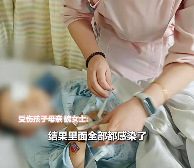 江西一5岁男孩在幼儿园被戳伤致左眼失明<strong></p>
<p>比特币现在价格</strong>，家长称老师用猪油涂抹试图消肿