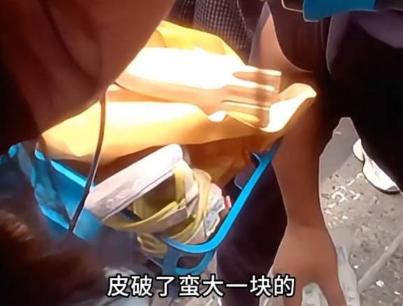 看着都疼<strong></p>
<p>购买比特币</strong>！上海街头一男子突然求助：10岁女儿被死死卡住！这个行为太危险→