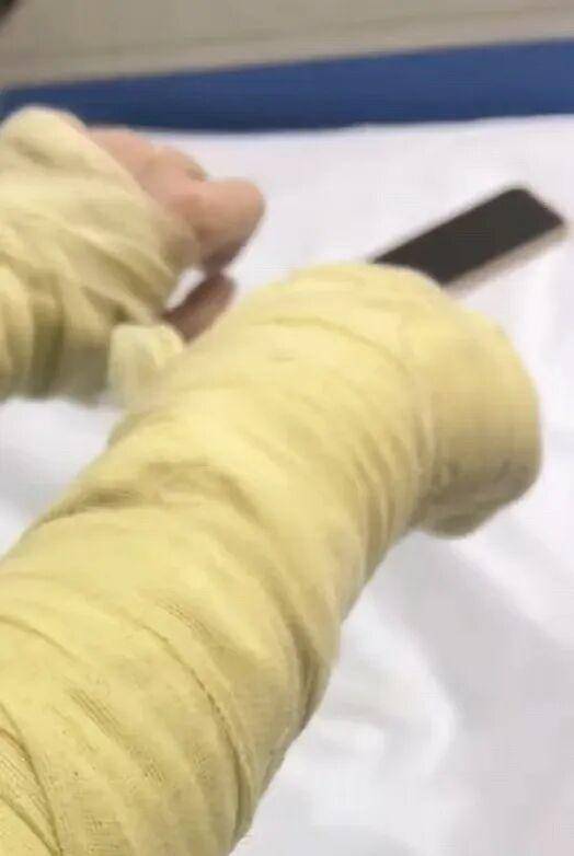 湖南一女主播被伪装的包裹炸伤<strong></p>
<p>购买比特币</strong>，永州公安：正在核实具体情况