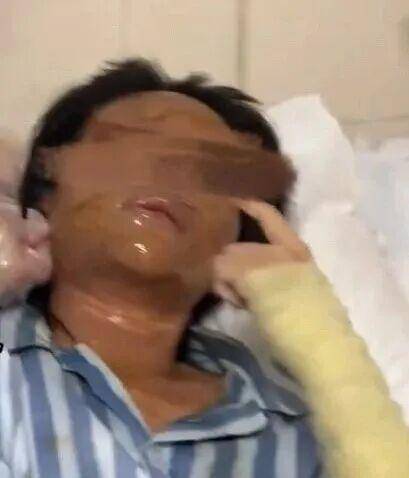 湖南一女主播被伪装的包裹炸伤<strong></p>
<p>购买比特币</strong>，永州公安：正在核实具体情况