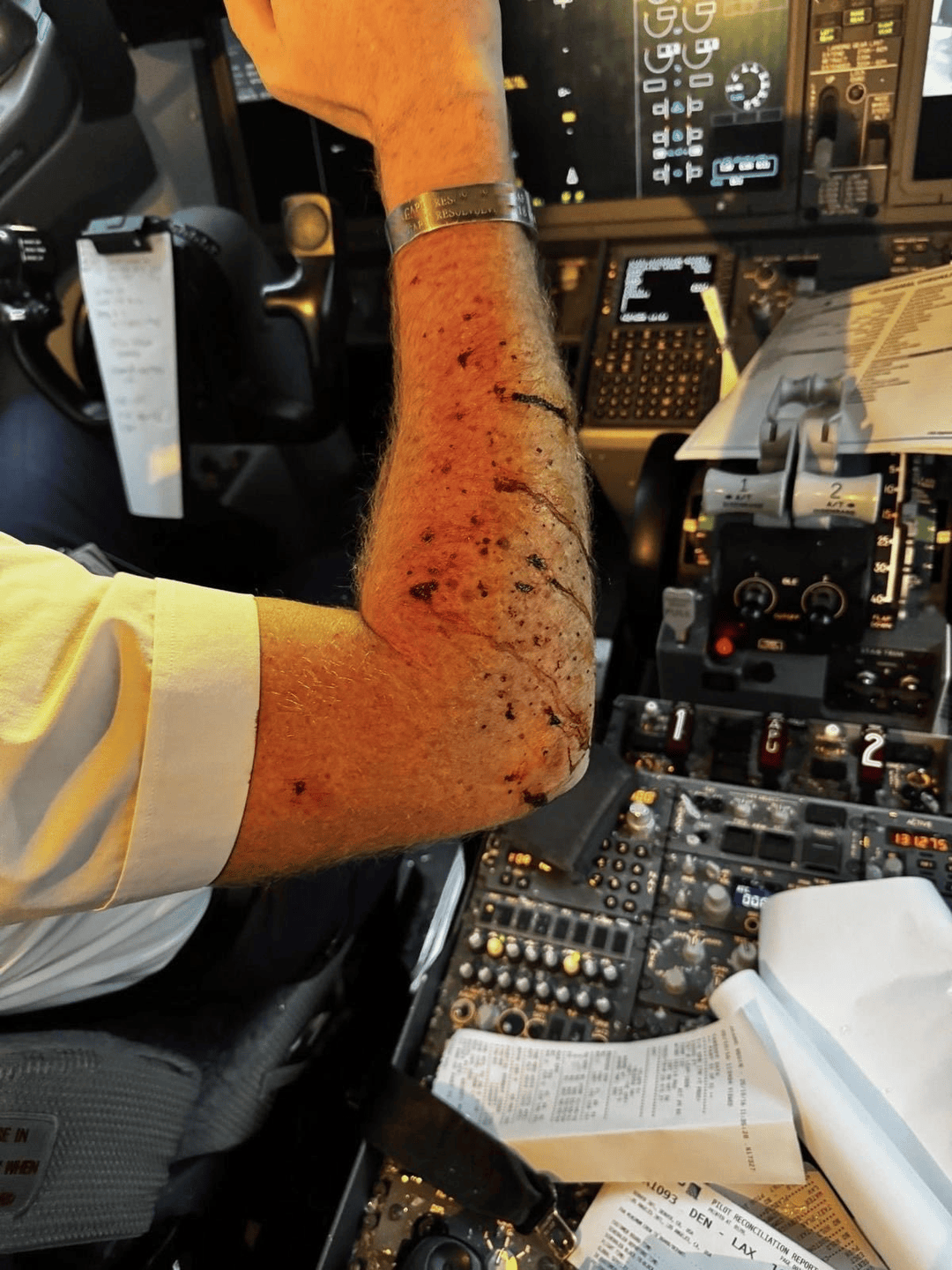 美客机驾驶舱风挡玻璃破裂<strong></p>
<p>比特币视频</strong>，自万米高空紧急备降！机上共140人，资深机长：或被陨石或卫星残骸撞击