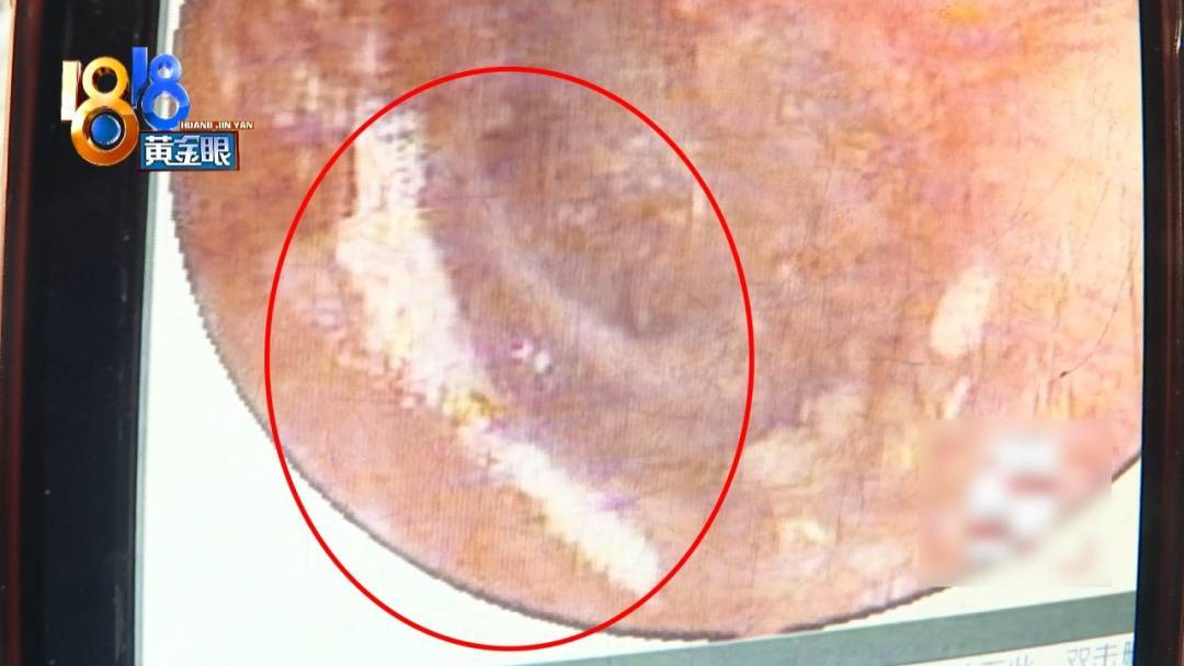 杭州姑娘痒了一整夜<strong></p>
<p>比特币软件</strong>，检查结果让她崩溃……浴场回应索赔：凭什么要两千？