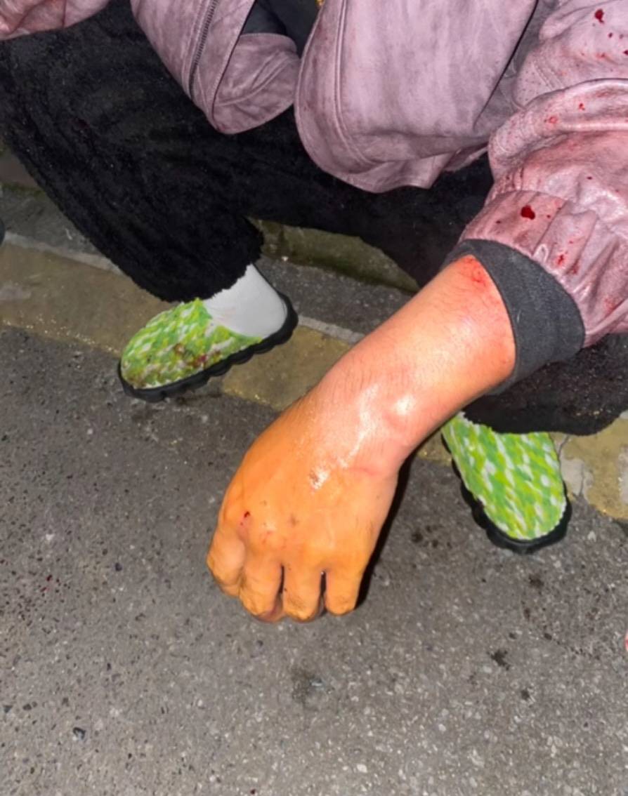 株洲女子夜间遭同小区大狗扑咬<strong></p>
<p>比特币一个多少钱</strong>,男子从二楼冲下死死摁住肇事狗,众居民:一定要表扬他