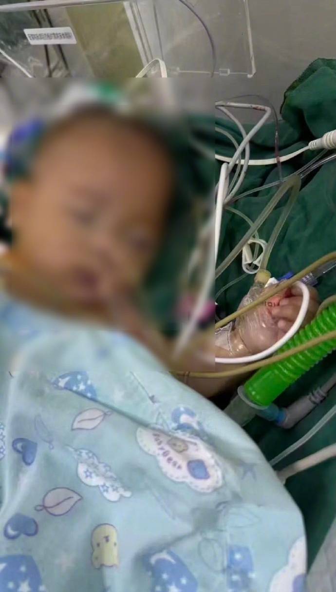 “小洛熙事件”涉事医院小儿胸心外科住院部已关闭<strong></p>
<p>现在比特币多少钱一个</strong>,胸心外科手术已暂停