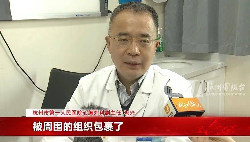 17岁小伙参军体检发现胸腔内有根5cm缝衣针<strong></p>
<p>比特币下载</strong>,父母回忆或是1岁时扎入,取出时已锈迹斑斑